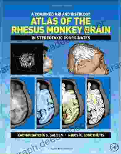 A Combined MRI And Histology Atlas Of The Rhesus Monkey Brain In Stereotaxic Coordinates