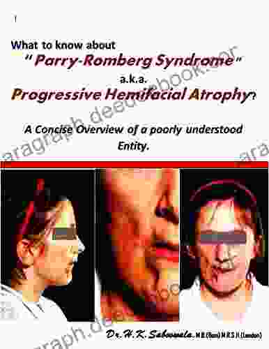 What To Know About Parry Romberg Syndrome A K A Progressive Hemifacial Atrophy? (A Concise Overview Of A Poorly Understood Entity )