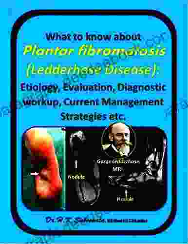 What To Know About Plantar Fibromatosis (Ledderhose Disease) : Etiology Evaluation Diagnostic Workup Current Management Strategies Etc