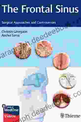 The Frontal Sinus: Surgical Approaches And Controversies